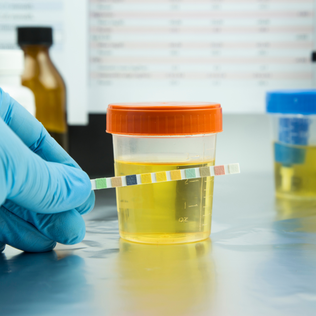 urine test